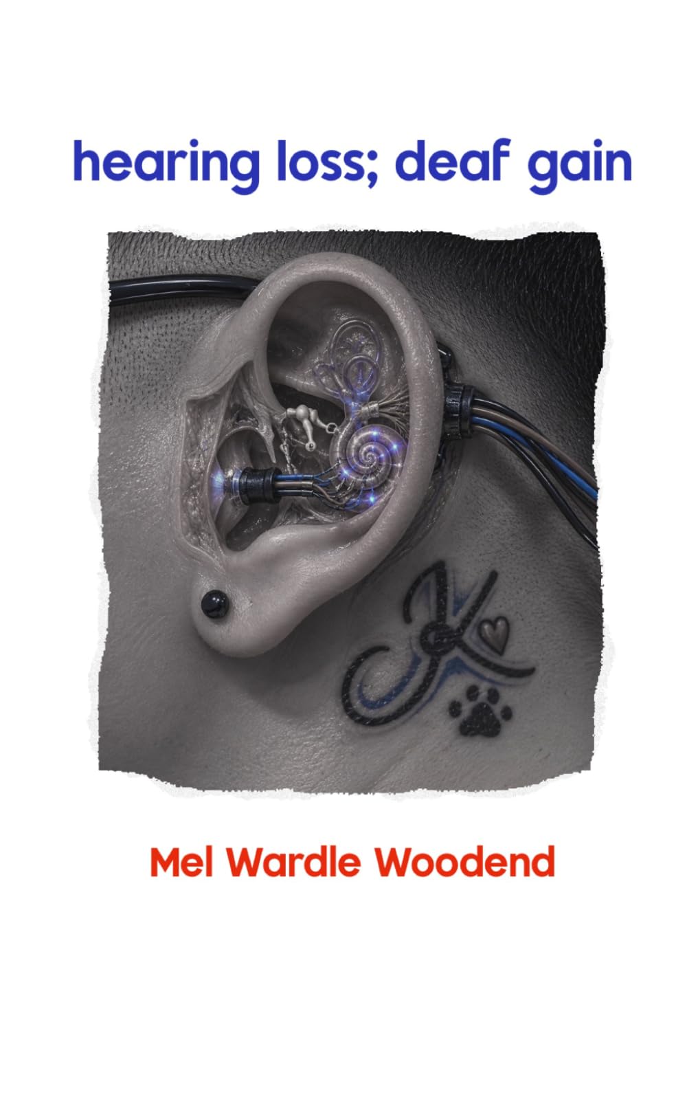hearing loss; deaf gain