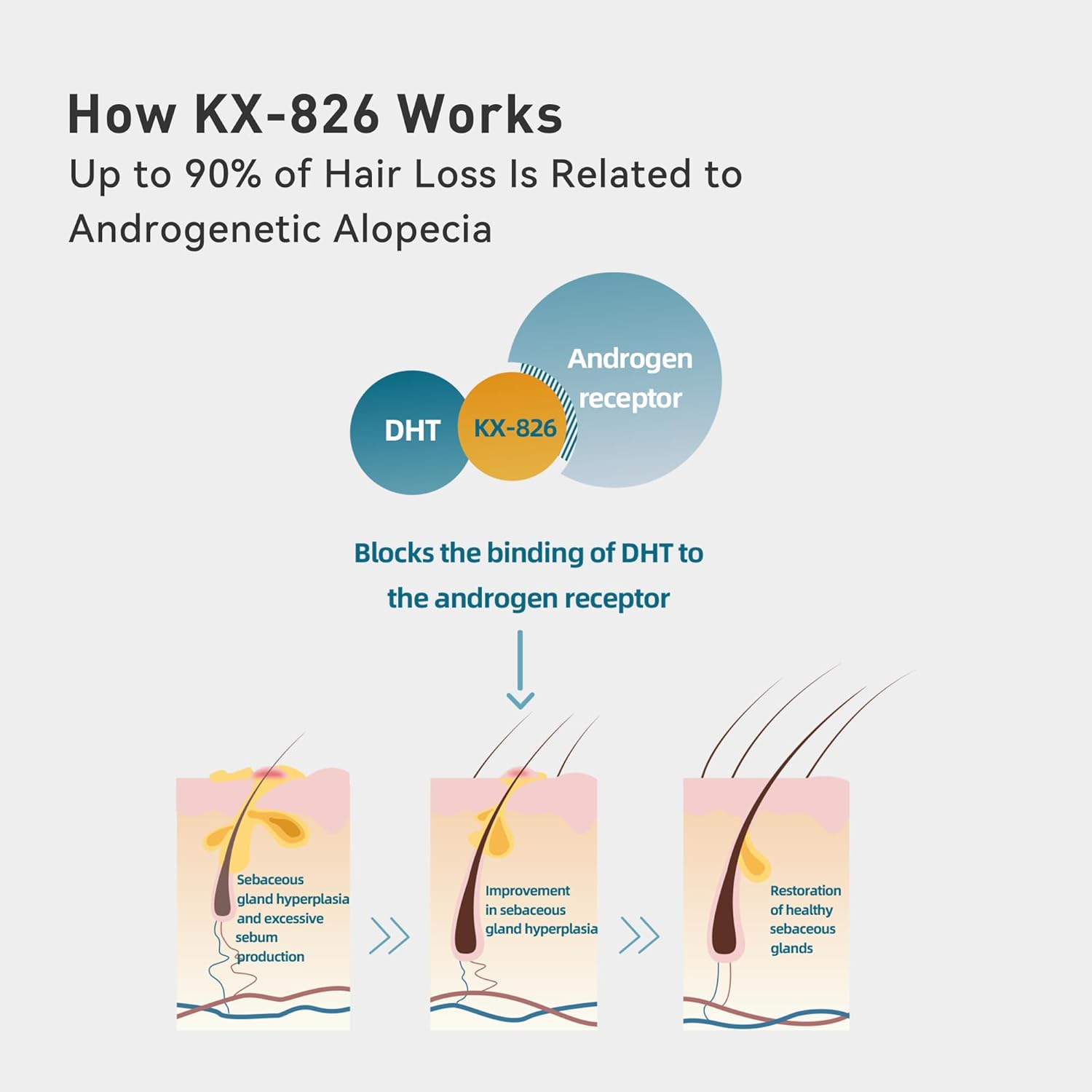 KINTOR 0.9% KX-826 Hair Regrowth Spray,Supporting Healthy Hair Growth,Oil Control, Hair Growth Products Group for Men&Women,Pro,60ml - Image 3