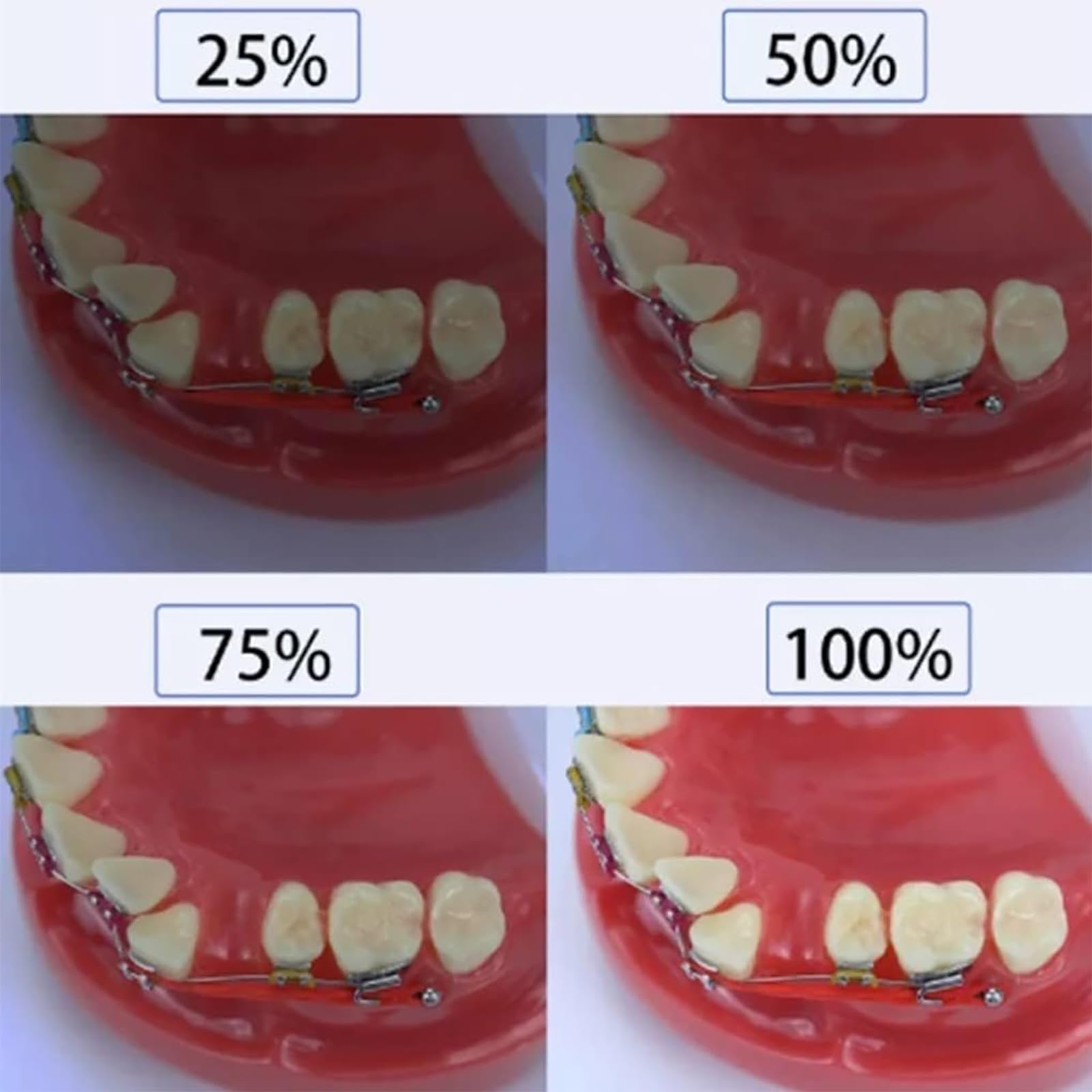 Cámara de fotografía dental con luz de relleno ajustable y soporte extraíble para imágenes orales claras en odontología clínica
