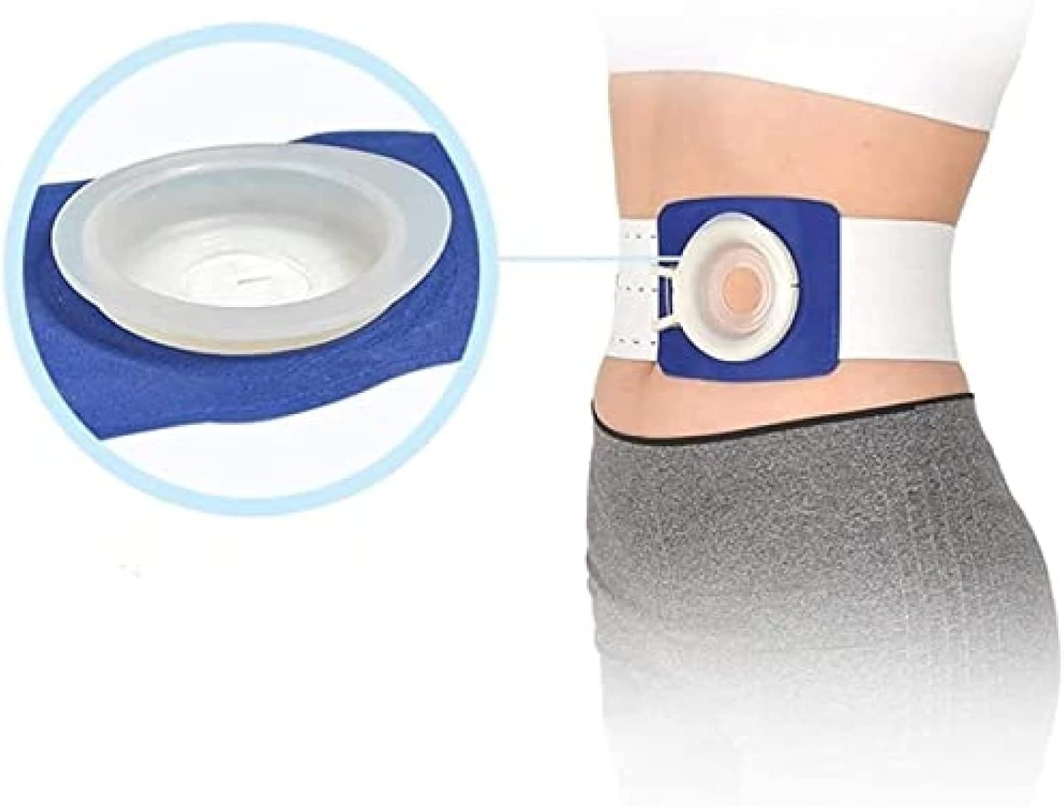 Amazon.co.jp 医療用ストーマベルト、ストーマサポートベルトヘルニア腹部バインダーストーマバンド、ストーマヘルニアサポートベルト