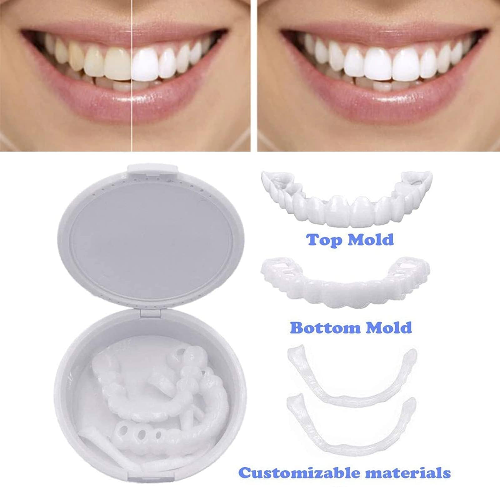 XLBHSH 2 Paia Di Faccette Snap In Denti, Denti Impiallacciati Superiore E Inferiore, Scatto Sulle Faccette, Per Donne E Uomini, Denti Impiallacciati Per Il Sorriso Perfetto Istantaneo Con Scatola - Foto 8