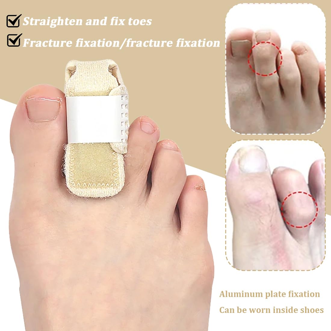 2Pcs Férula para Dedo en Martillo, Corrector Dedos del Pie, Soporte de Puntera Ajustable en Forma de U, Enderezador de Dedos de Los Pies, Para Fracturas de Dedos de Los Pies, Esguince, Martillo(Beige)