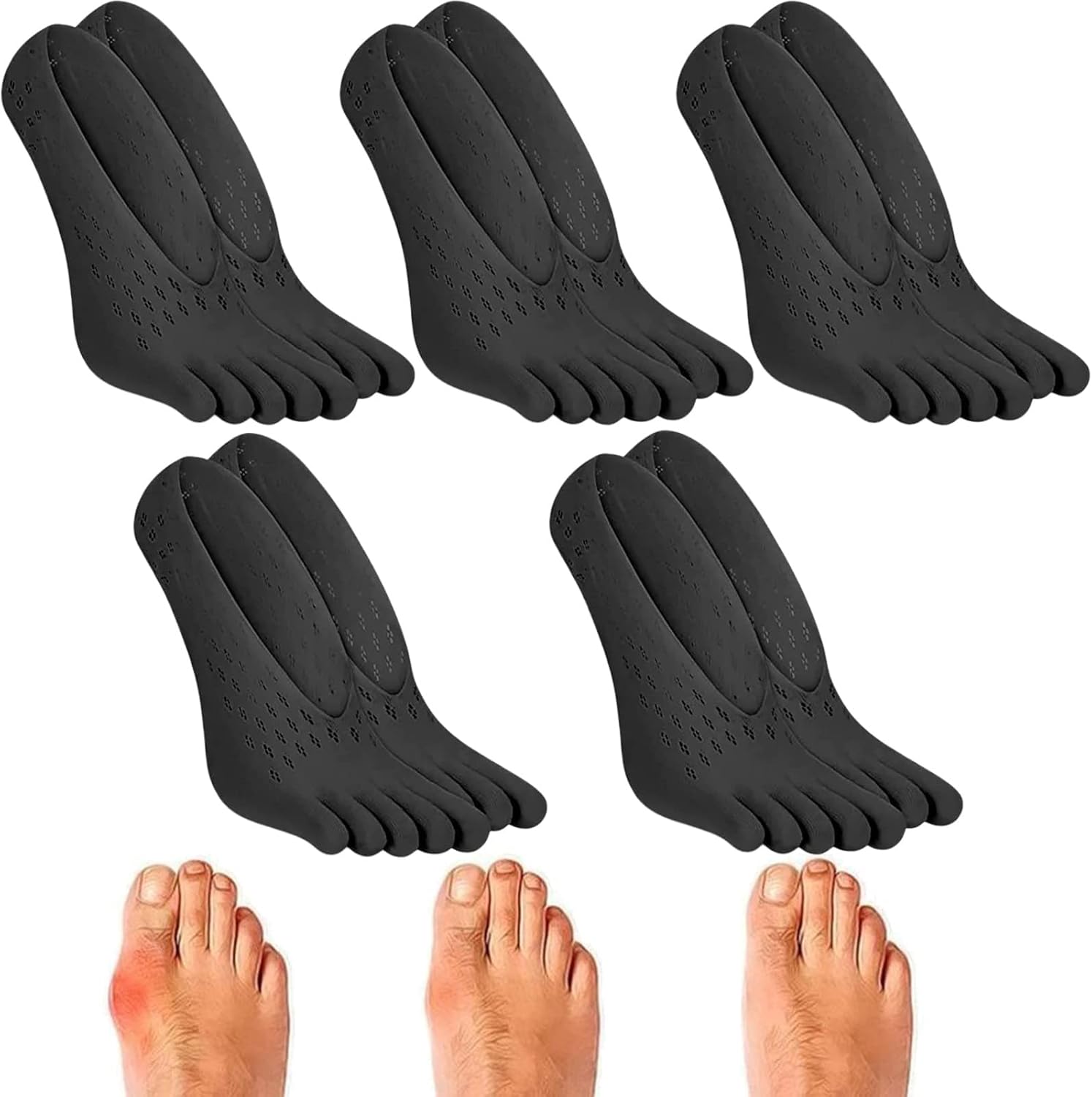 BIERDAN 5 Pairs of Projoint AntiBunion Health Socks Anti