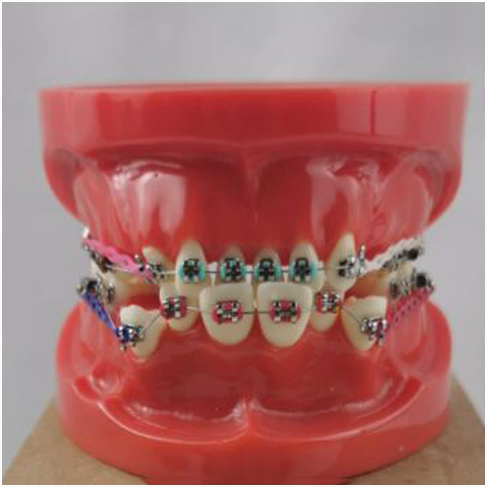Model zębów Typodont – dentystyczny model ortodontyczny z metalowym i ceramicznym wspornikiem, model wyjaśniający dla dorosłych i dzieci (czerwony)