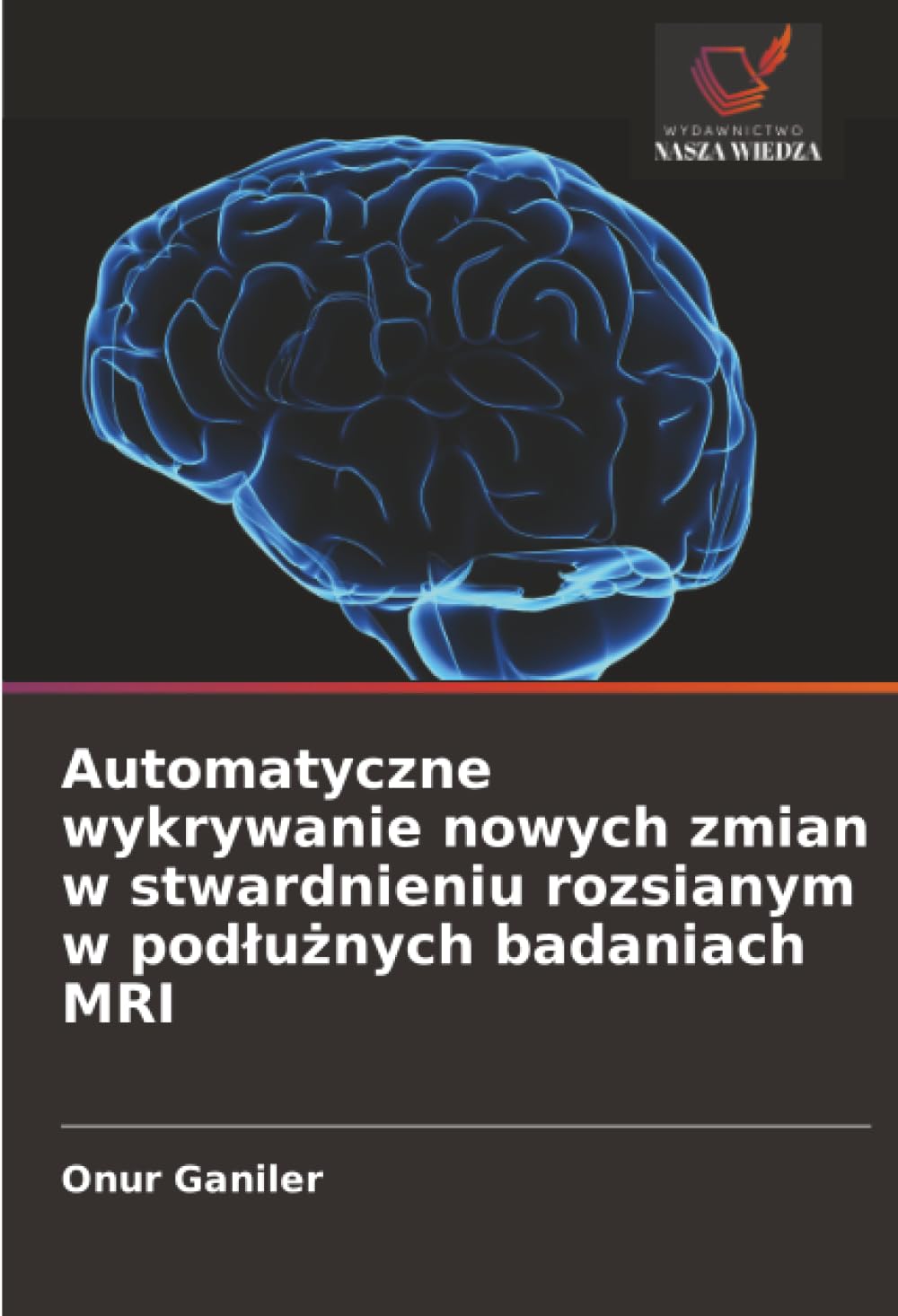 Automatyczne wykrywanie nowych zmian w stwardnieniu rozsianym w podlużnych badaniach MRI