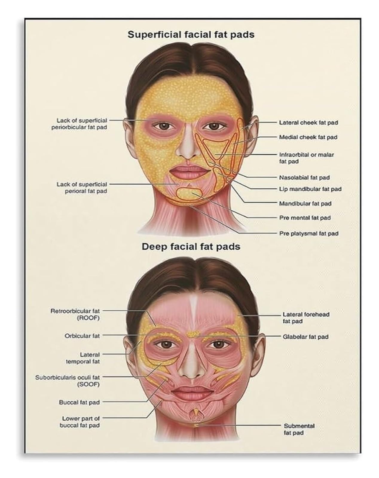 MDBJTCYZN Face Anatomy Educational Poster: Facial Fat Pads Chart for Esthetician and Surgery(Unframed,08x12inch(20x30cm))