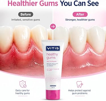 Vitis Gums Toothpaste 100ml