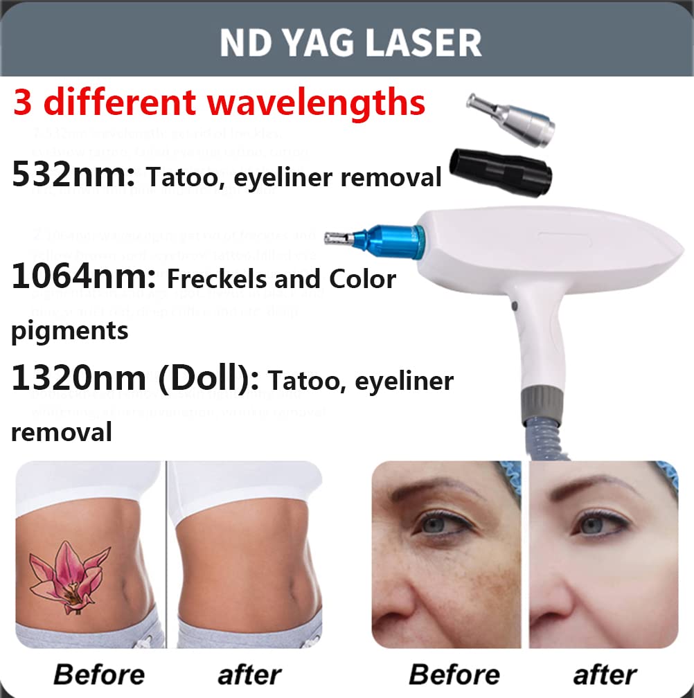IPL OPT Epilatore per la rimozione e macchina per la rimozione dei tatuaggi Nd Yag, macchina di bellezza E-light per la rimozione di sopracciglia/contorno degli occhi/nei