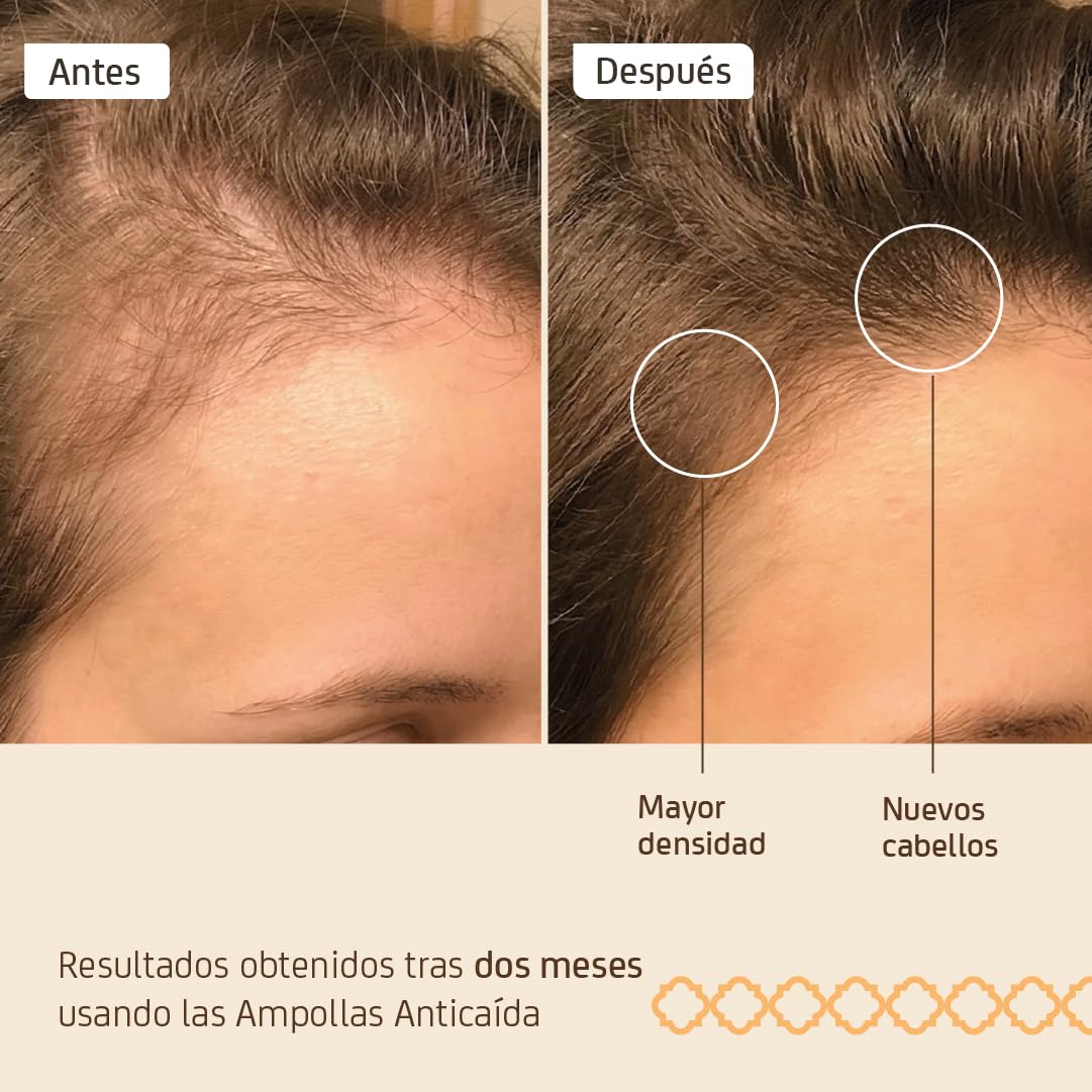 Nuggela & Sulé Ampollas Anti-Caída Efectiva. Con Extracto de Cebolla Roja. Fortalece y Frena la caída del cabello. Efecto Rápido. Tratamiento. 4 x 10 ml