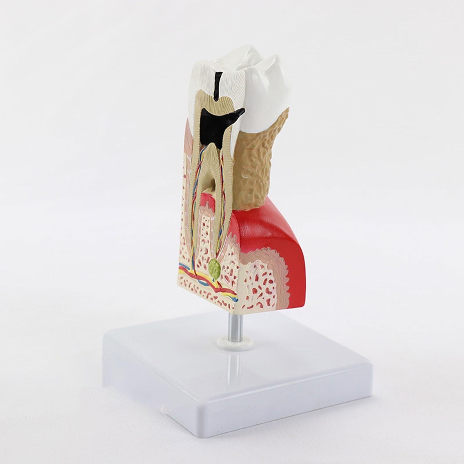Anatomiczny Model Ludzi, Powiększony Model Opieki Ludzkich, Próchnicy, Próchnicy, Akcesoria Medyczne, Materiał Dydaktyczny, Model Anatomiczny.