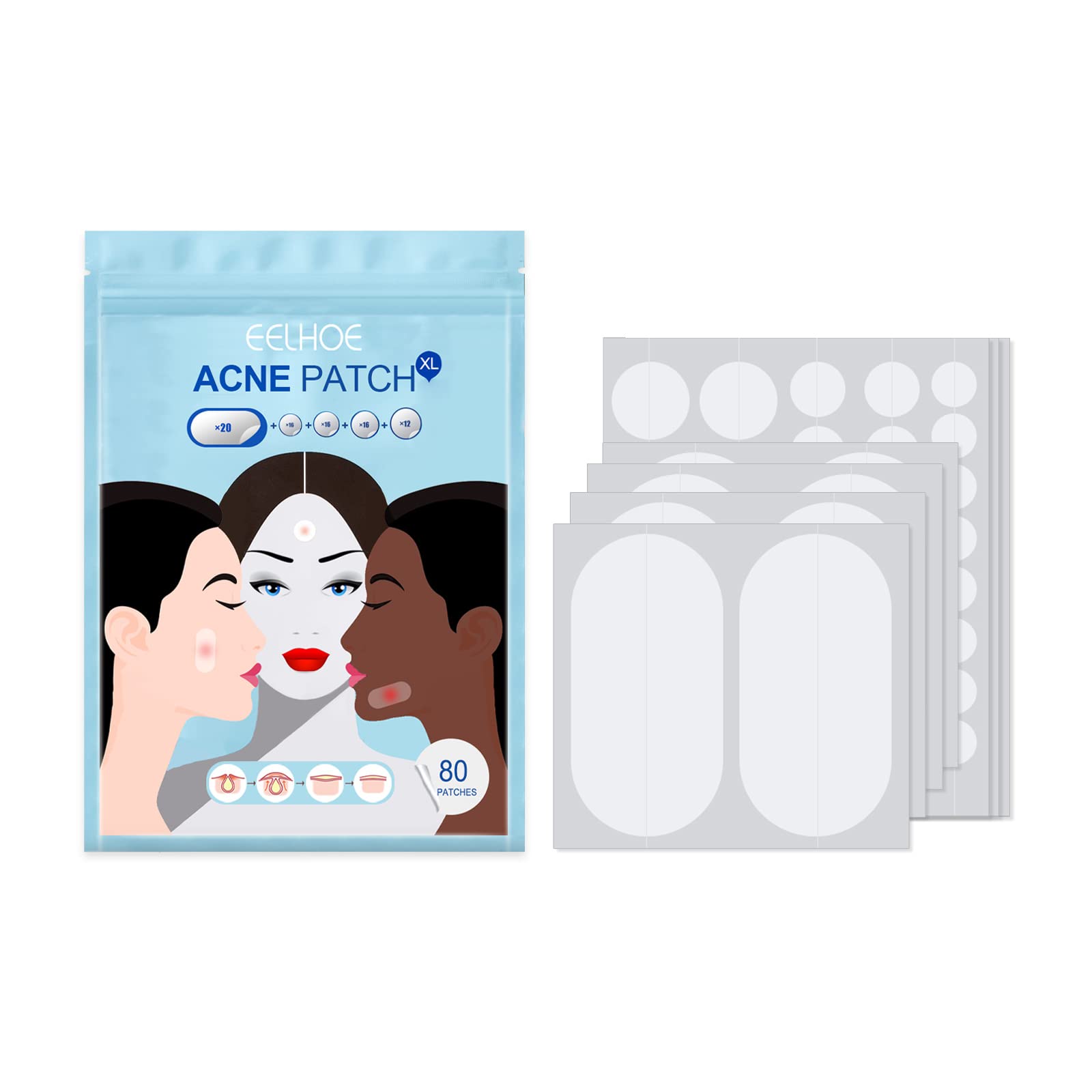 Parche De Tratamiento Facial Antiacné Acne Strips 80pcs Lucha Contra Espinillas Aceite De CaléNdula Aceite De áRbol De Té áCido SalicíLico Suave Para Sensible Unisex