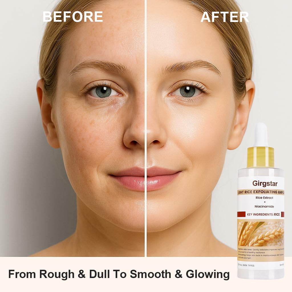 White Rice Peeling Ampoule - Gentle Exfoliating Serum with Niacinamide & Rice Extract | Brightening Face Treatment for Dead Skin Removal | All Skin Types (80ml/2.7oz)