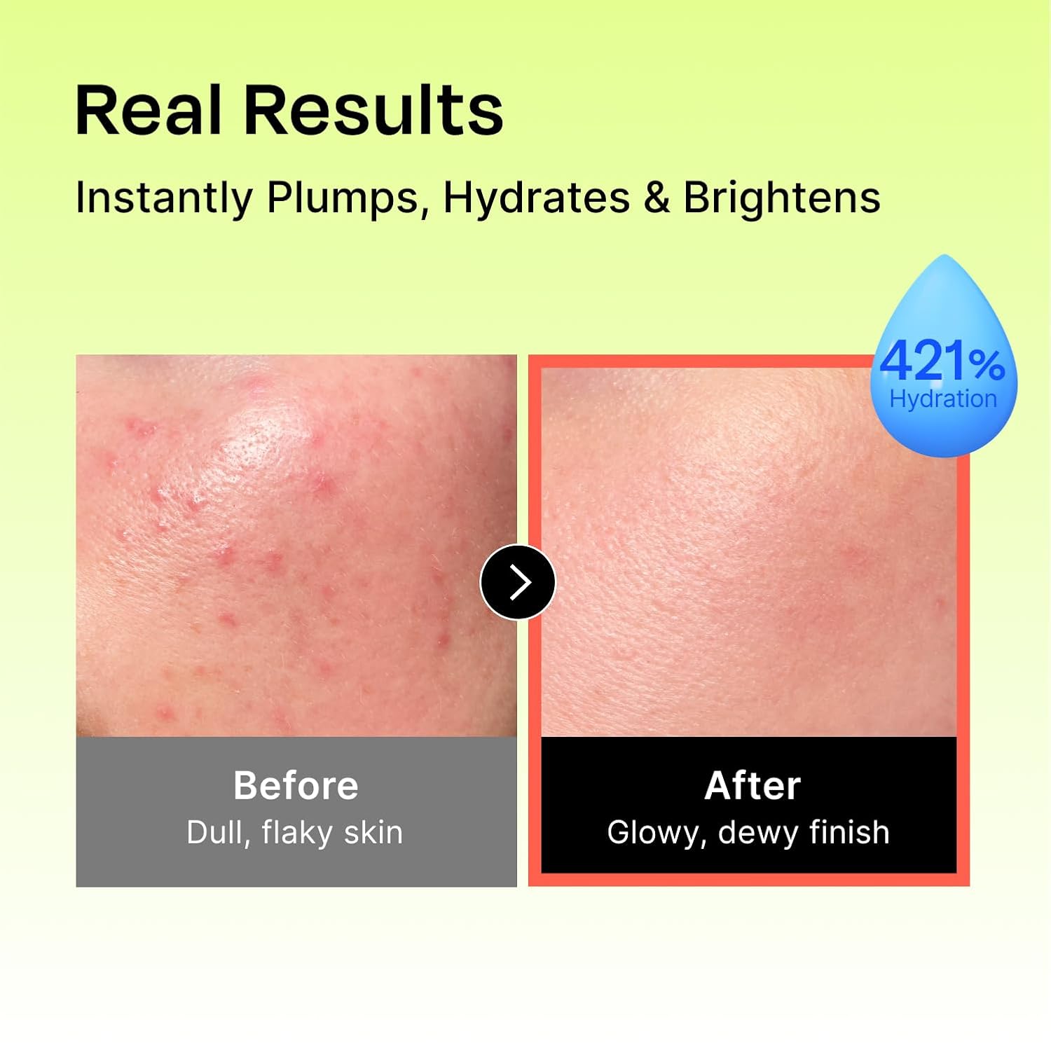 Celladix Hyaluronic Intense Cream – 95% Pure Hyaluronic Acid with Niacinamide & Panthenol – 100 Hours of Hydration, Barrier Strengthening Care for Smooth, Radiant Skin – Korean Skincare, 2.70 Fl Oz - Image 3