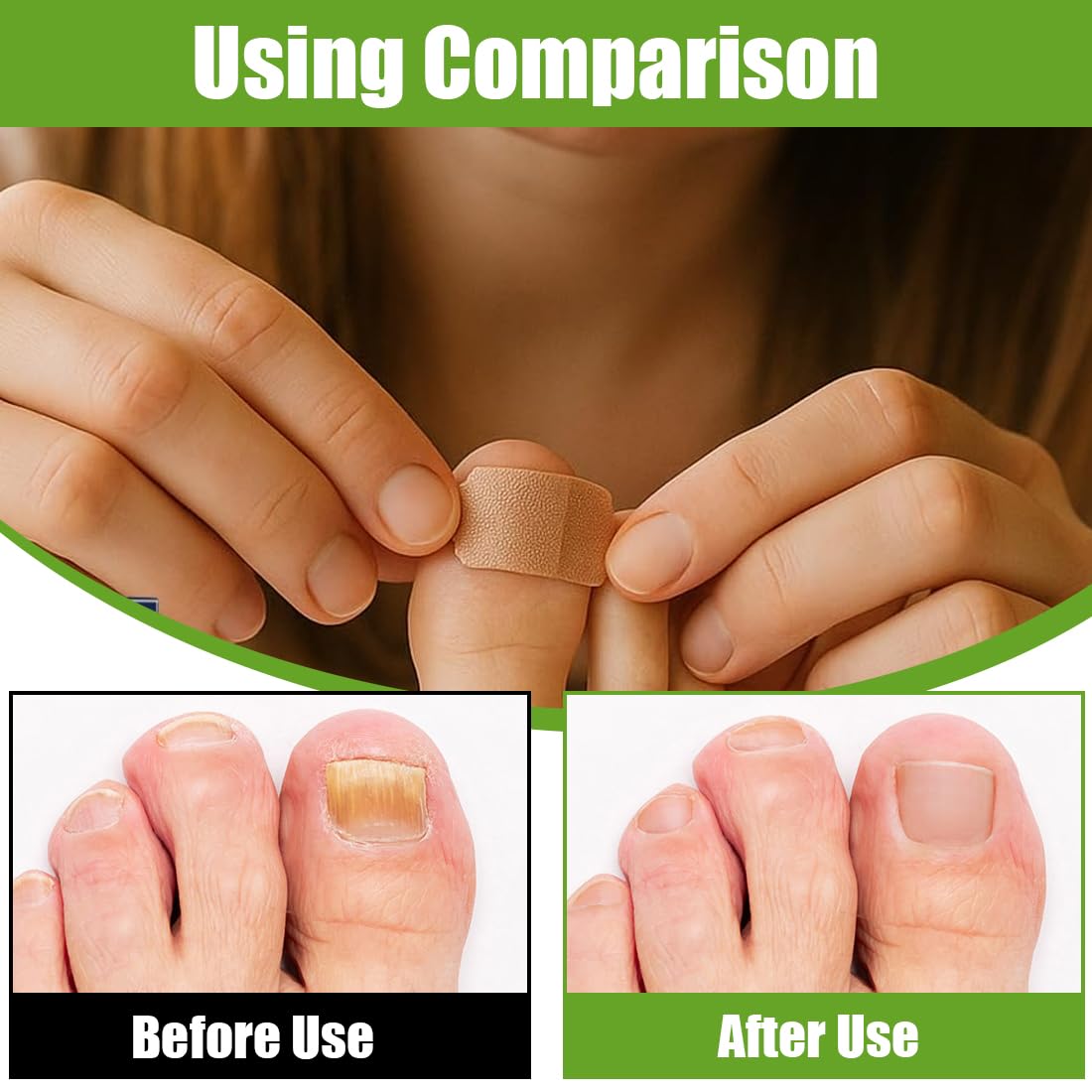 Parche-Uñas Hongos | Antimicótico para Uñas de Pies y Manos | Cura Uñas Dañadas, Amarillas & Quebradizas | Tecnología Hidrogel | Cuidado Natural
