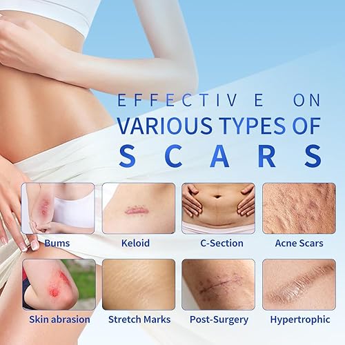 Miniatura 3 de Láminas de silicona para cicatrices de 1.6 x 78 pulgadas, rollo de 6.6 ft, tratamiento de eliminación de cicatrices de silicona de grado médico para