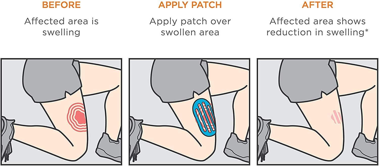 KT Tape Recovery Patch - Tape for Swelling Relief : Health & Household
