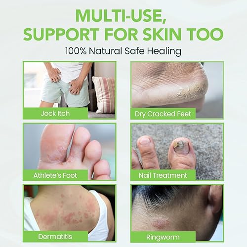 Miniatura 5 de THENA - Bálsamo para tratamiento de pies de atletas, fórmula Power6 extra fuerte con árbol de té, menta neem, repara pies secos y agrietados,