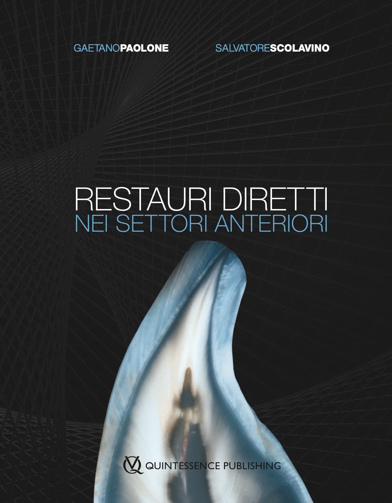 Restauri diretti nei settori anteriori