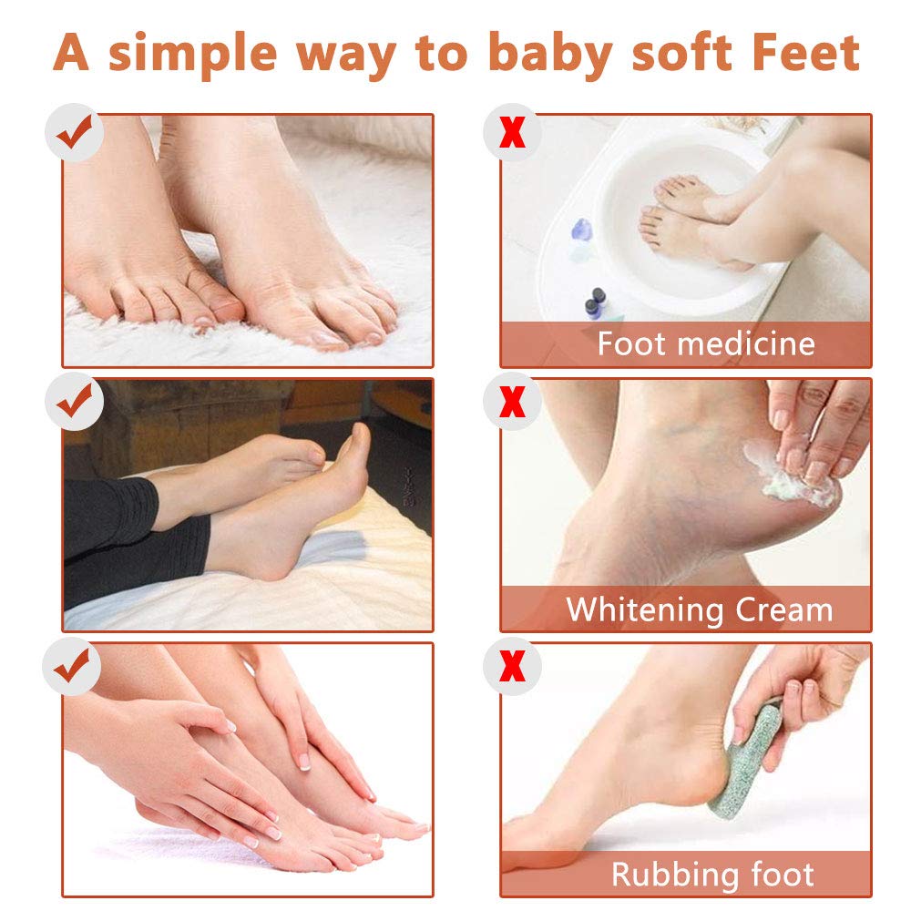 Foot Peel Mask-3 Pack,Foot Exfoliating Set With Coconut Serum,Baby Foot Peeling-Cracked Feet Treatment,Dead Skin Heel Scraper For Feet,Disposabel Feet Spa Socks,Intensly Moisturizes Repair and Softens The Feet
