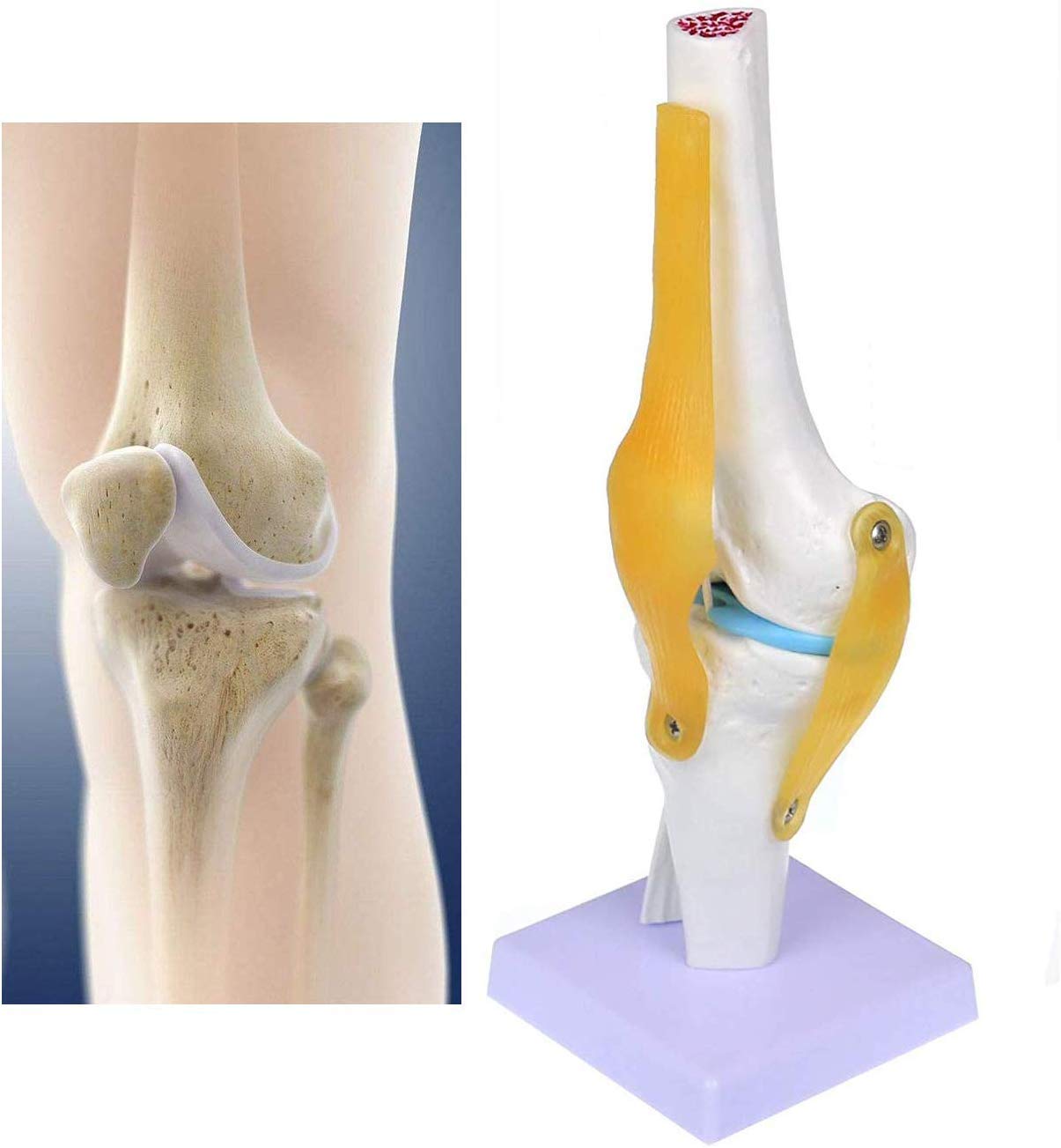 Buy Human Knee Joint Model,Anatomical Medical Simulation Model Knee Joint with Ligaments Model