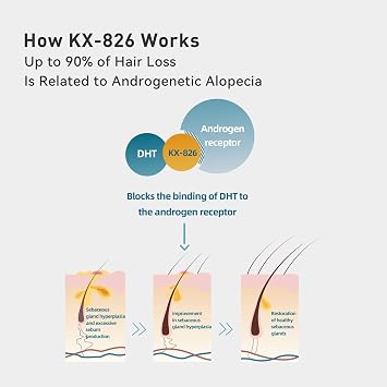 KINTOR 0.5% KX-826 Hair Regrowth Spray for Men, DHT Blocker Hair Growth Products,Plant-Based Extract Hair Revitalizing Spray for Oil Control and Stronger Hair Roots,60ml