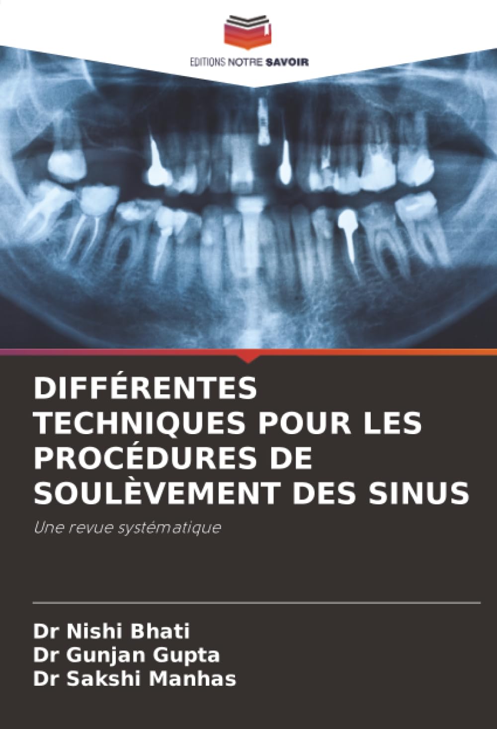 DIFFÉRENTES TECHNIQUES POUR LES PROCÉDURES DE SOULÈVEMENT DES SINUS: Une revue systématique