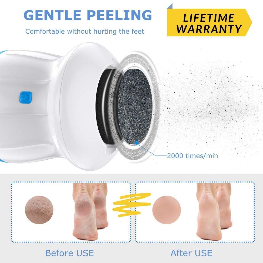 Portable Electric Vacuum Adsorption Foot Grinder - USB Electronic Foot File Pedicure Tools, Dual-Speed CÃ llus Remover - Feet Care Perfect for Dead,Hard Cracked Dry Skin (White) 2