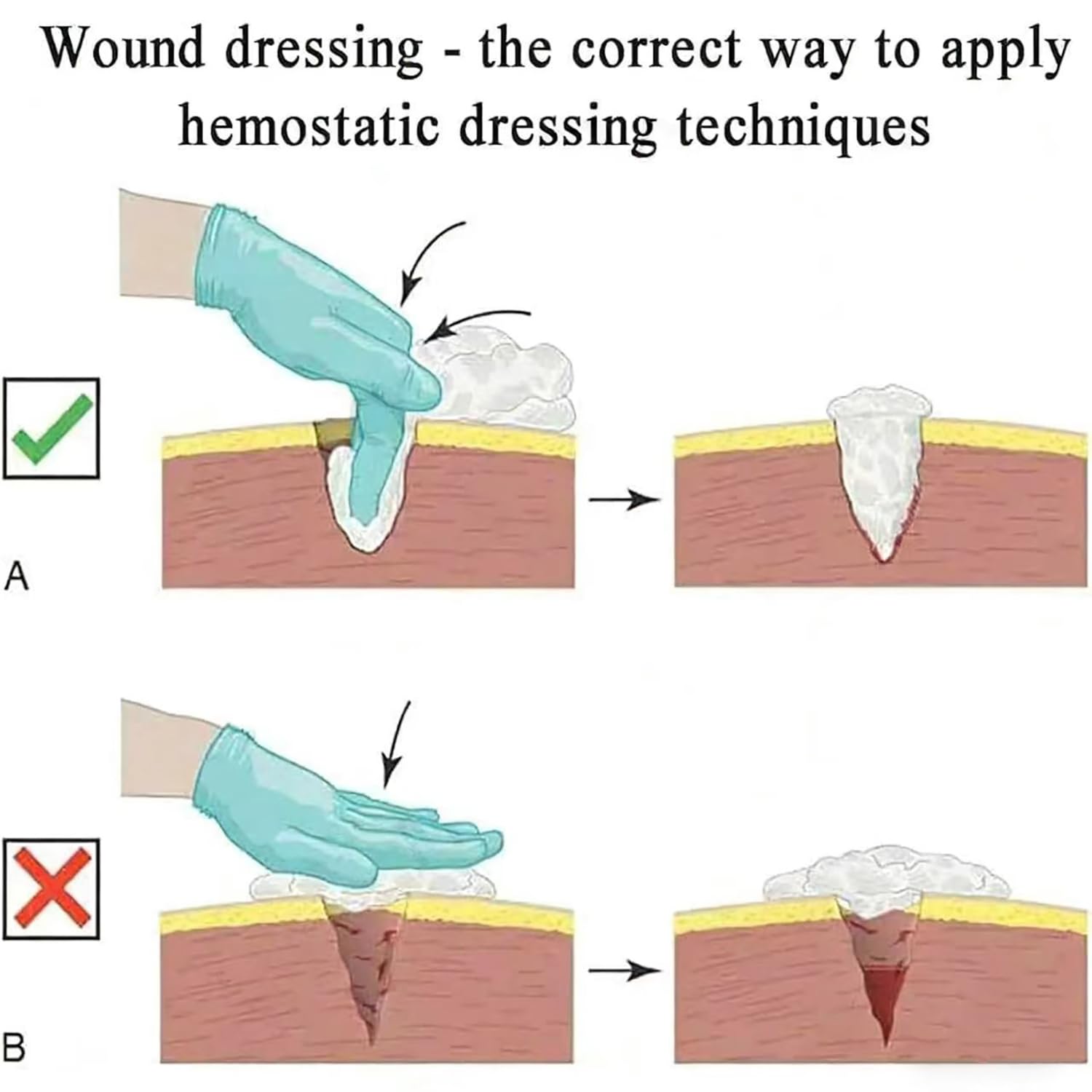 Kit di addestramento per la cura delle ferite per la pratica della sutura di primo soccorso e l'educazione medica