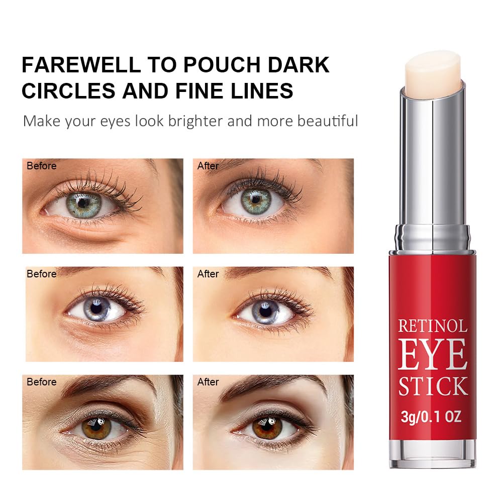 Retinol Eye Stick, Retinol Eye Cream, Eye Balm Stick - Image 4