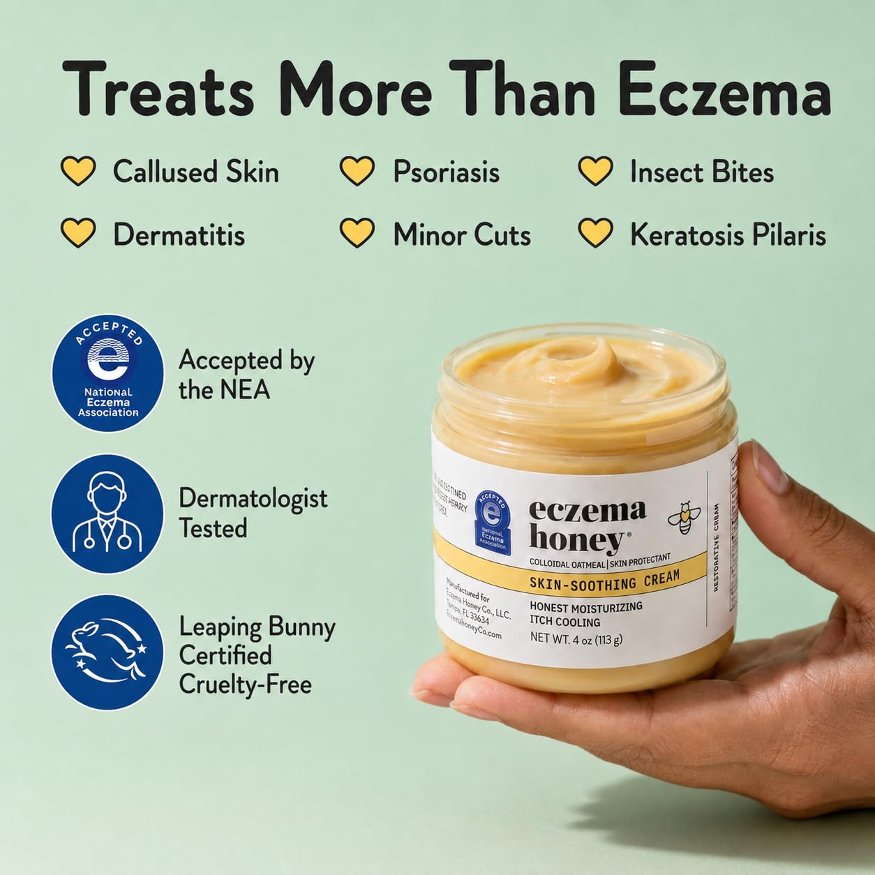 ECZEMA HONEY Original Skin-Soothing Cream for Dry Itchy Skin (4 Oz) — Amazon image 5