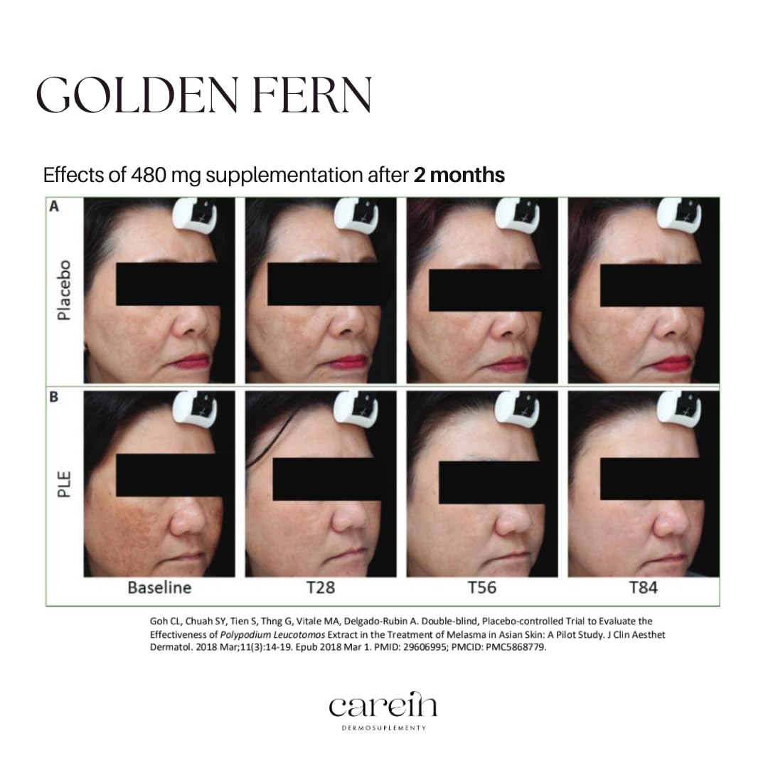 Skin Anti Pigmentation Refill - Gegen Pigmentflecken und Hyperpigmentierung - Mit Polypodium, Glutathion & Zink - 60 Vegane Kapseln - Carein