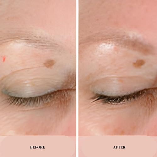 Miniatura 4 de Anew Lifting Dual Eye System Contour Care Cream con tecnología de protinol ayuda a corregir, reafirmar y suavizar el contorno de ojos para un