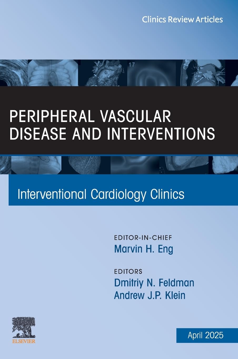 Peripheral Vascular Disease and Interventions, An Issue of Interventional Cardiology Clinics: Volume 14-2 (The Clinics: Internal Medicine, Volume 14-2)