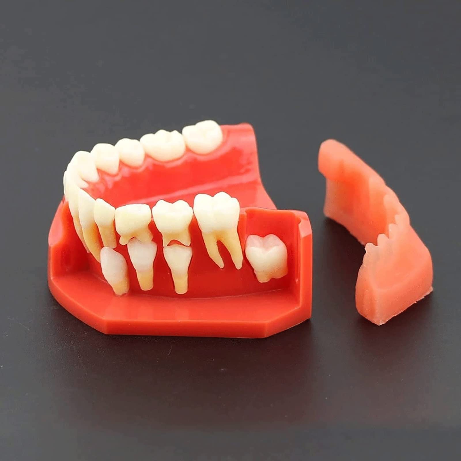 Modelli di Insegnamento Dentale, Modello di Dimostrazione Dentale per Denti Rimovibili per Malattie Dentali Modello per La Cura dei Denti Dentali per Bambini di 9-12 Anni