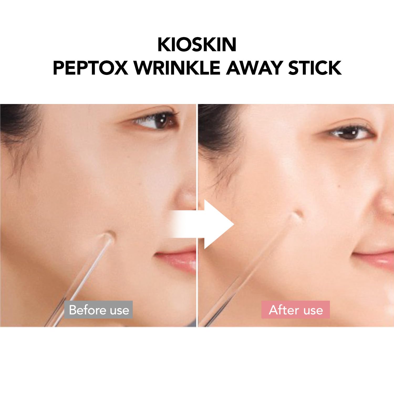 107% Crow’s Feet Improvement, 117% on Neck Lines & 109% on Nasolabial Lines – Boosts Elasticity – With Botulinum-Inspired Peptide and Collagen – Korean Skincare Korea’s Best Skincare Stick Kioskin - Image 5
