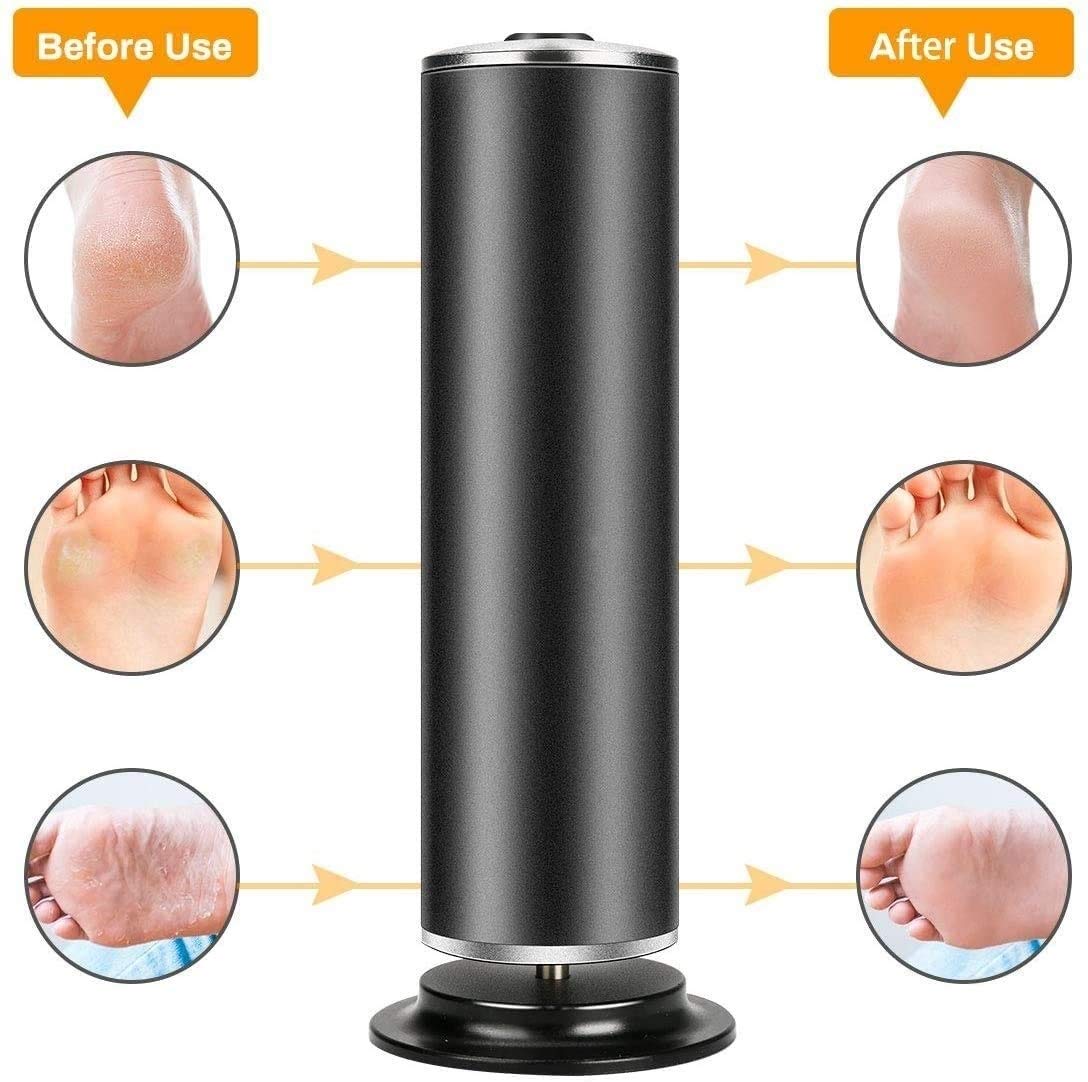 Callo File di Piede Elettrico di rimozione for Il Piede, Pedicure Piede Cura for la Pelle Morta Duro Incrinato Secco, con Dischi di Ricambio 60pcs (Color : Black)