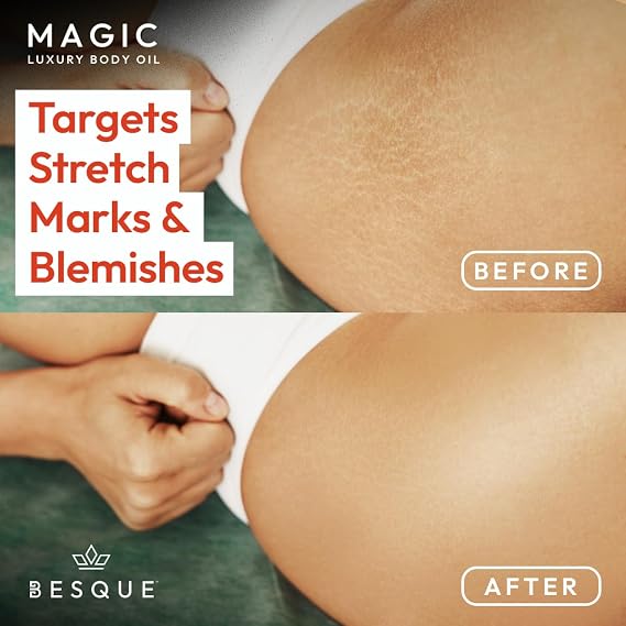 Besque Unscented Magic Body Oil - Hydrating Body Oils for Women - 100ml | Unscented Skin Care Body Oils for Women That Plump, Tighten & Firm Skin With Natural Ingredients, Made in UK