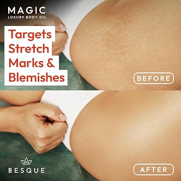 Besque Unscented Magic Body Oil - Hydrating Body Oils for Women - 100ml | Unscented Skin Care Body Oils for Women That Plump, Tighten & Firm Skin With Natural Ingredients, Made in UK