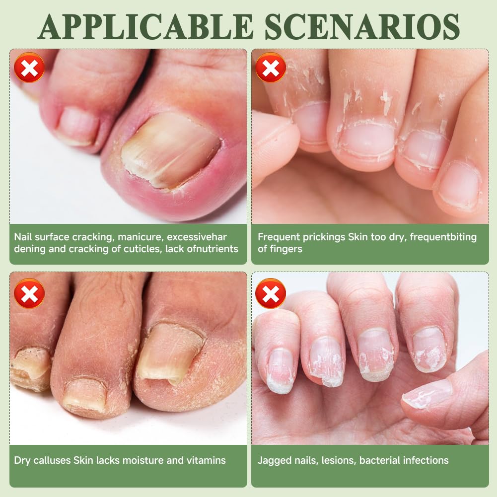 3 sztuki Nail Care Pen olejek do paznokci, żel do pielęgnacji paznokci, sztyft do pielęgnacji paznokci u rąk i stóp z olejkiem z drzewa herbacianego i aloesem, wspomaga wzrost paznokci