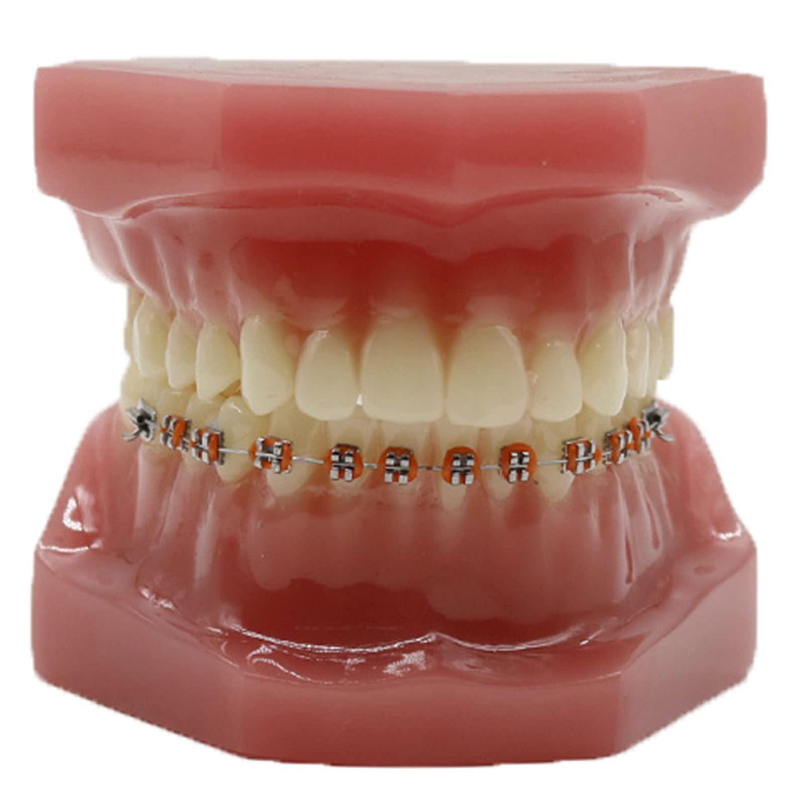sjdoPulse Standard Orthodontic Oral Tooth Model - Simulated Oral Tooth Teeth Demonstration Model - Anatomy Teeth Model with Metal And Ceramic Bracket