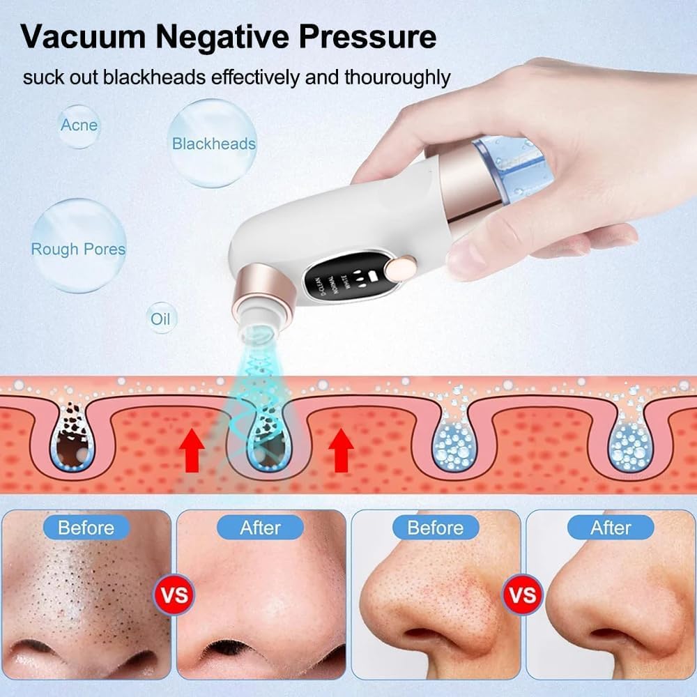 Aspirateur Point Noir Extracteur de Comédons Nettoyage des Pores avec 6 Sondes 3 Modes, Professionnel Extracteur de Point Noir Electrique Tire Nettoyant de Pores Soin Visage