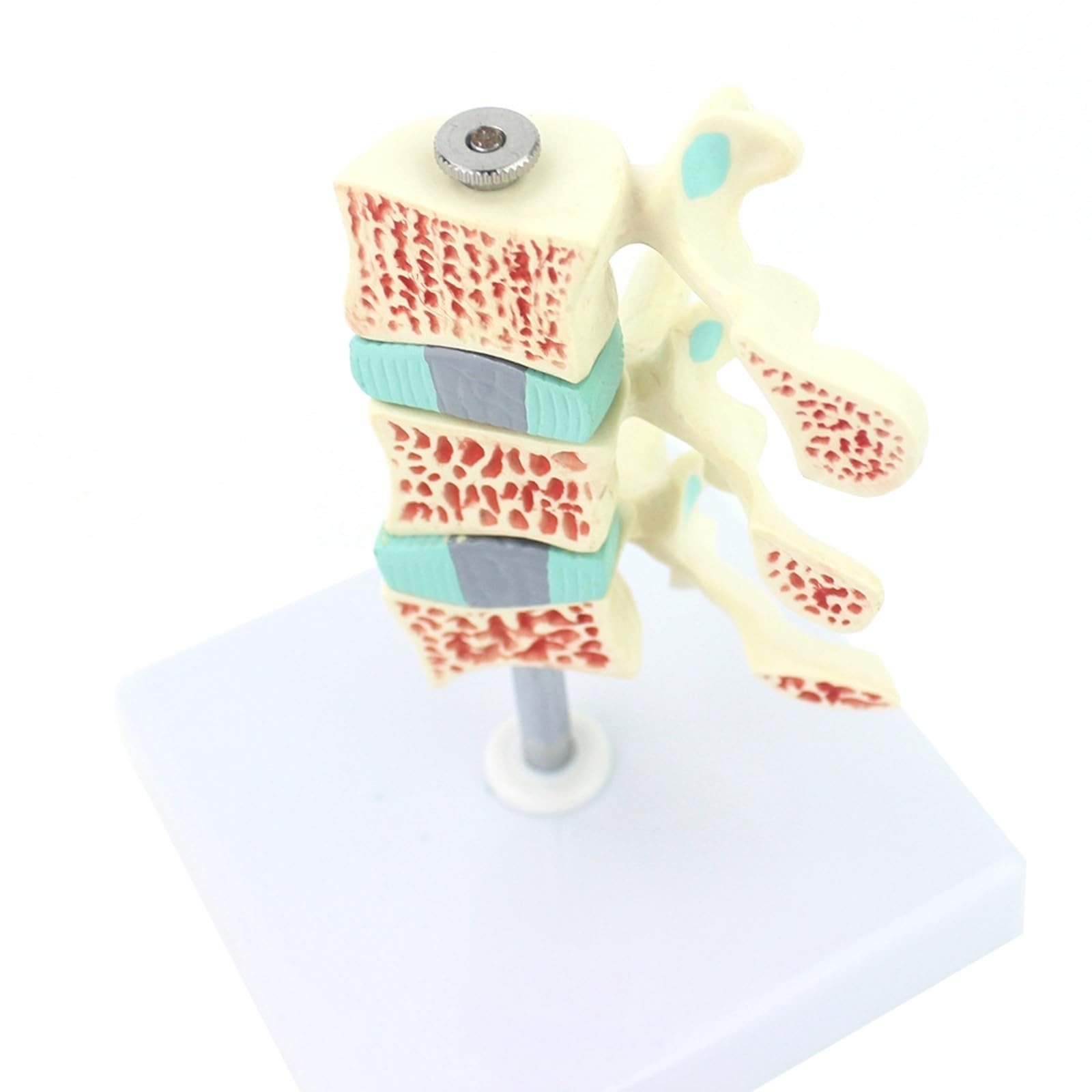 Model Osteoporozy Ludzkiej Lędźwiowych Trzysegmentowy Przekrojony Koloryzowane Krążki Międzypierścieniowe Regulowany Stojak Białe Podłoże PVC Dla Studentów Medycyny Ortopedów Fizjoterapeutów