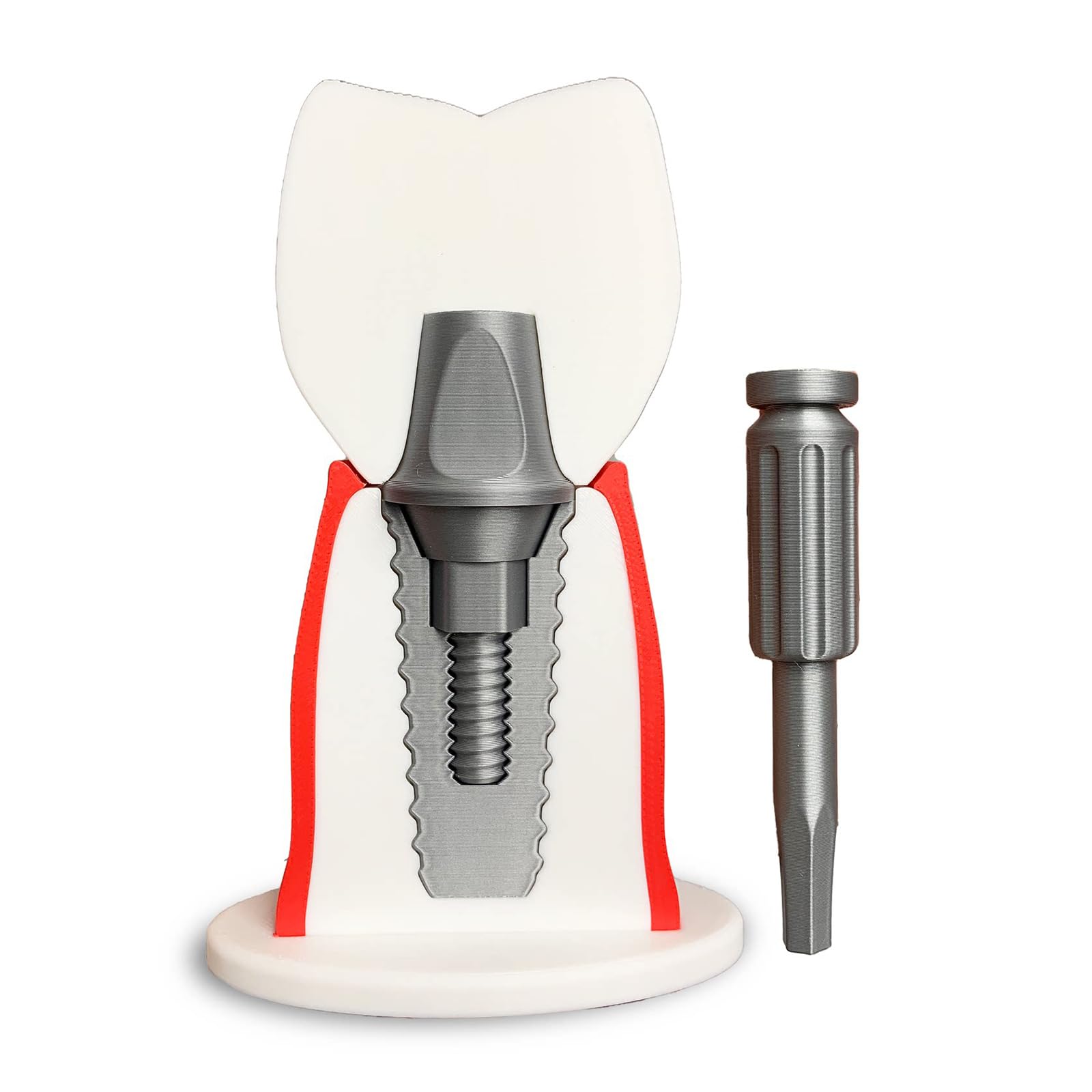 YRQMGSF Dental Model Dental Implants Teaching Demonstration Model with Removable Crown Implants for Dental Education and Demonstrations,26cm,one size