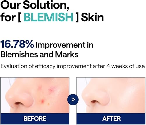 Miniatura 4 de MEDIHEAL Madecassoside - Almohadilla de tóner facial cuadrada de algodón con centella asiática y madecassoside, anti manchas para mejorar el tono de