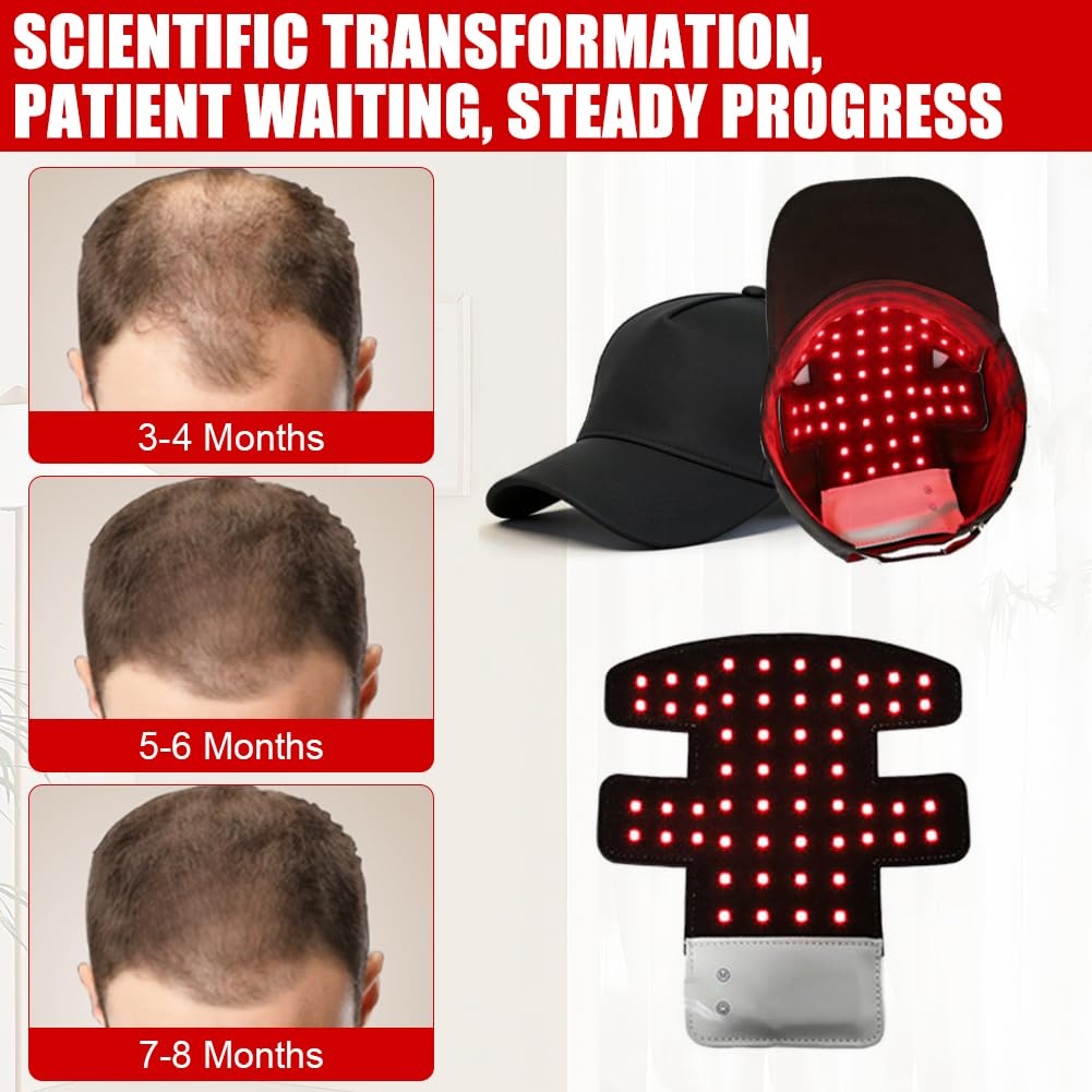 Rotlicht Haare LED Cap, 660nm+450nm+850nm Rotlichtlampe Haarwachstumskappe mit 4 Modi, Abnehmbarem Rotlicht Panel, Red Light Therapy Haare Anti-Haarausfall, Einstellbare Größe Cap für Männer/Frauen