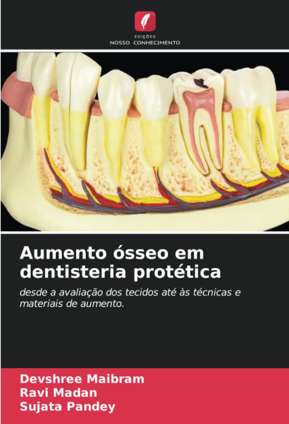 Aumento ósseo em dentisteria protética: desde a avaliação dos tecidos até às técnicas e materiais de aumento. (Portuguese Edition)