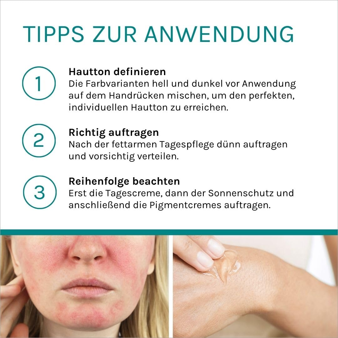 benevi Pigmentcreme 2 x 20 ml zum gezielten Abdecken von Rötungen, Pickeln, Unreinheiten oder als Make Up Ersatz. Kaschiert zuverlässig erweiterte und rote Äderchen bei Couperose & Rosacea (hell)