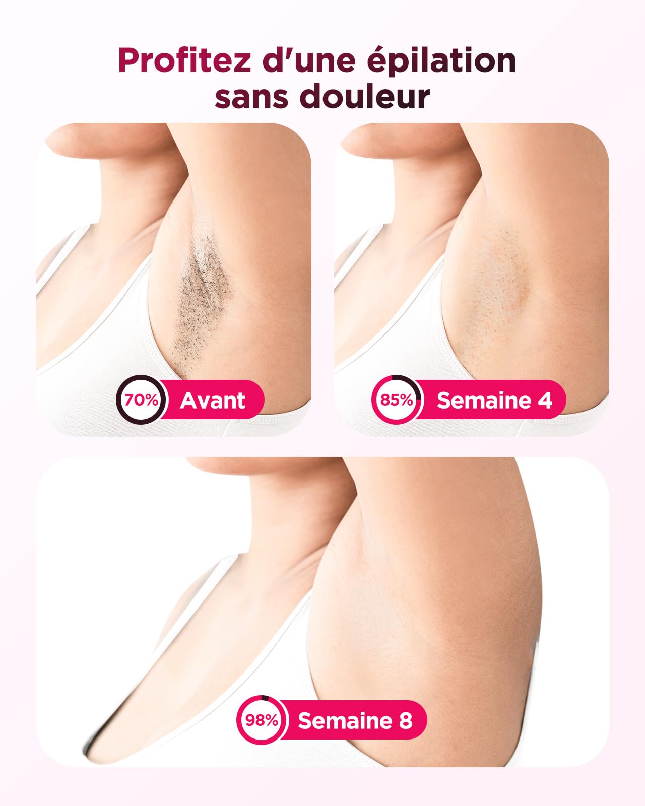 Haarlosy