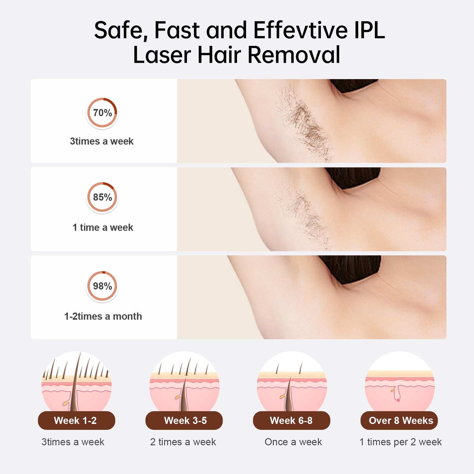 Laser Hair Removal, Sextupole Hair Removal Device with Ice Cooling