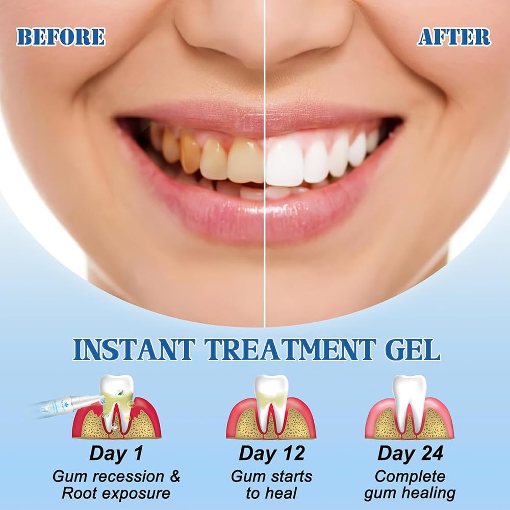 Gum Protect Repair Dental Gel, Elycura Gum Gel, Oral Care Therapy Formula, Natural Support for Gums Comfort & Repair, Teeth Whitening Essence Pen, Professional Gum Health Solution (1 Pack)